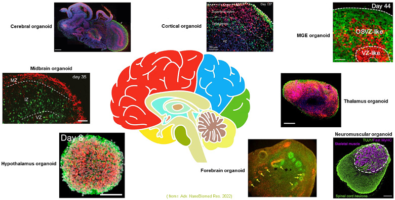 圖4 已報(bào)導(dǎo)的腦類器官類型.jpg